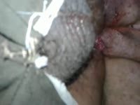 culito atorado (Nudo de Perro)